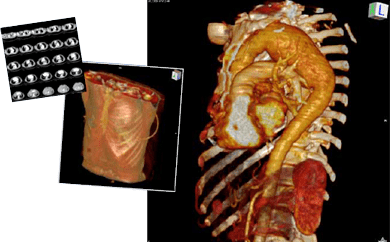 CT images of the thorax